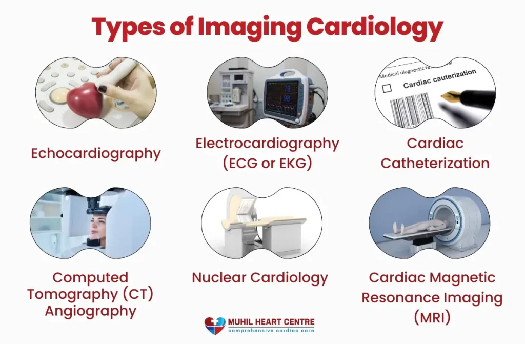 Imaging Cardiology in Vellore | Muhil Heart Centre