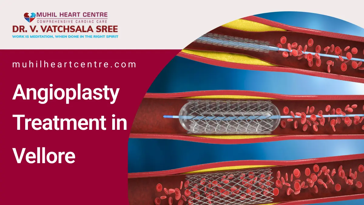 Angioplasty Treatment in Vellore | Muhil Heart Centre