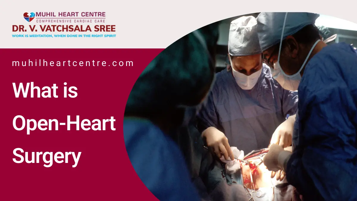What Is Open-Heart Surgery | Muhilheartcenter